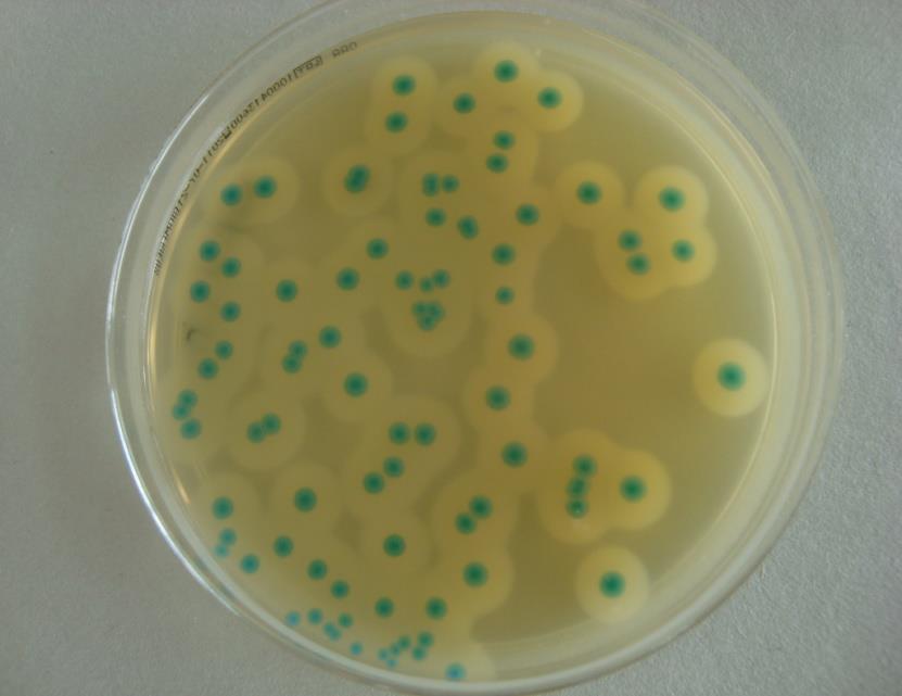 Example: specificity ALOA Criterion: blue/green colonies with