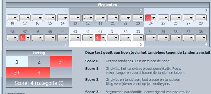 In het vak onder het kopje Meting verschijnen de hoogste scores voor de betreffende sectie. U ziet hieronder een voorbeeld.