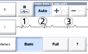 Vring Aring. INSTRUCTIES VOOR HET INSTELLEN VAN DE HARTRITMEWEERGAVE 1. Selecteer de toets Adjust Display aan de rechterkant van het Rhythm Display. Het venster Weergave aanpassen verschijnt. 2.