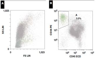 Minimal residual disease (MRD) Cancer cells MRD THERAPY RELAPSE MRD: few remaining cancer cells after therapy, often below detection limit, eventually cause cancer relapse.