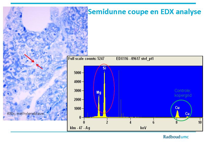 Longbiopten / EDX: EM