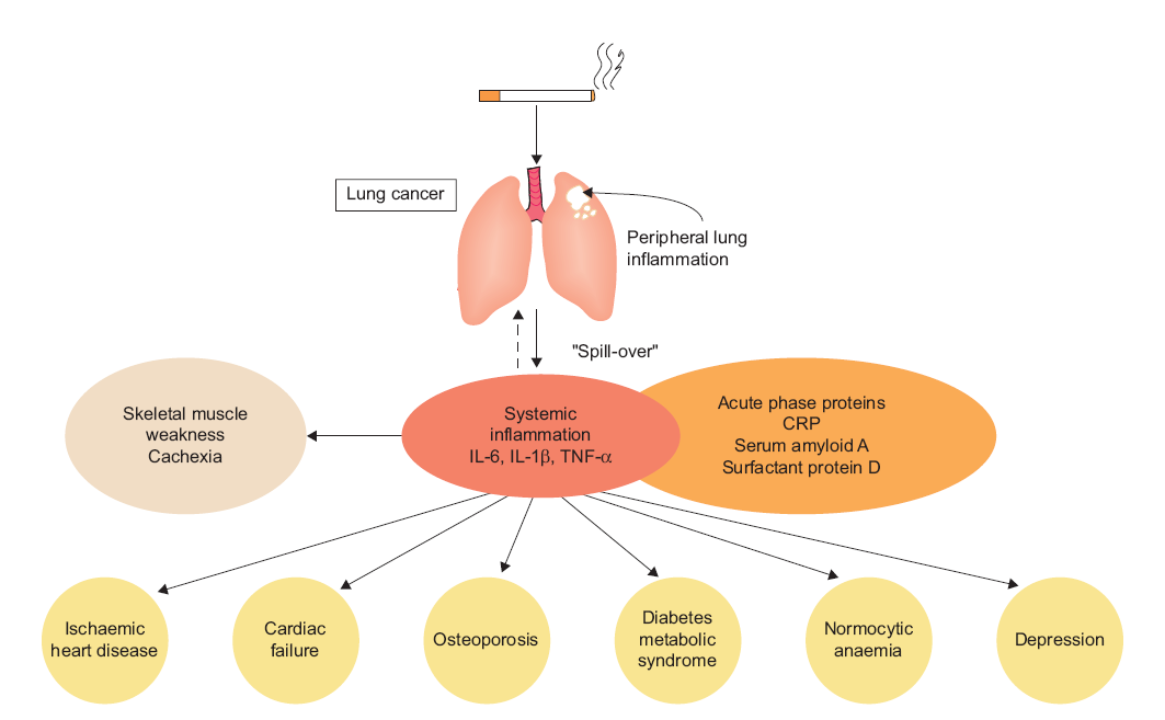 COPD en co-morbiditeit: