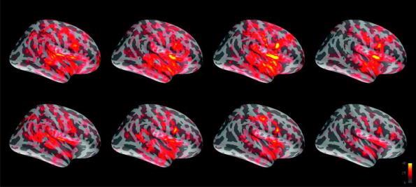 200, 300, and 400 ms after auditory offset.