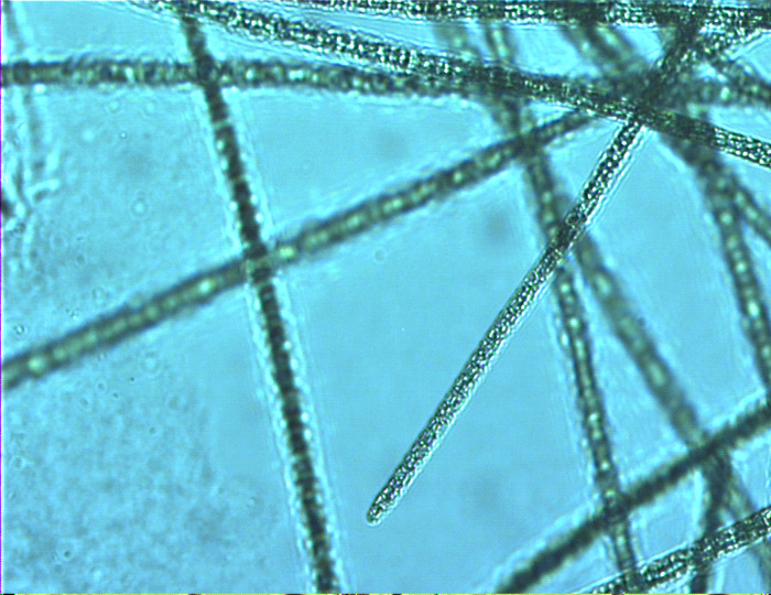 Cyanobacteriën Microcystis