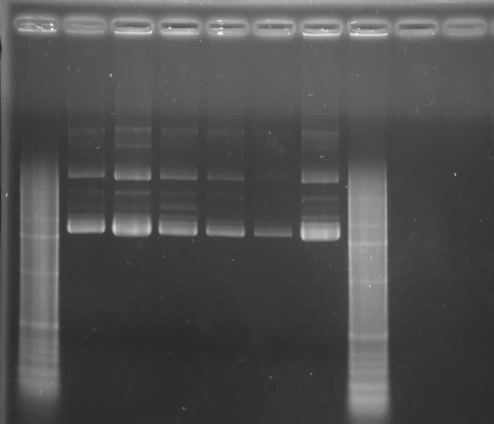 Open circulair DNA Supercoiled DNA 3054 bp 2036 bp 1636 bp 1018 bp Figuur 3.