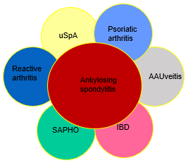 o inflammatoire rugpijn o sacroiliitis met of zonder spondylitis primaire pathologie wellicht inflammatoire enthesopathie o peesaanhechtingen die chronisch ontsteken o belasting is uitlokkende factor