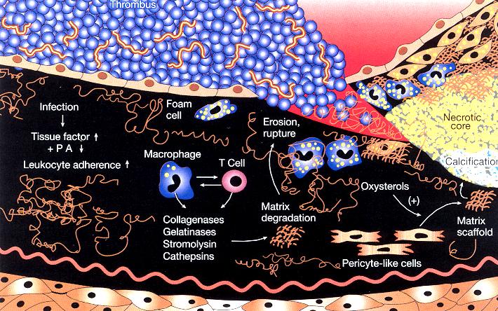 Thrombotische