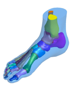 Hoofdstuk 6. Modellering kraakbeen 89 dan daarna nog gegenereerd door middel van boolean operaties ten opzichte van botstructuur en kraakbeen (fig. 6.10). Figuur 6.