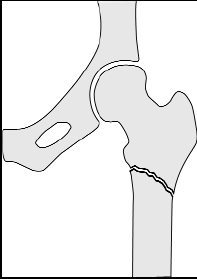 U kunt ook een telefonische afspraak maken met de verpleegkundig specialist. U maakt deze afspraak via de polikliniek Orthopedie. De verpleegkundig specialist belt u dan terug.