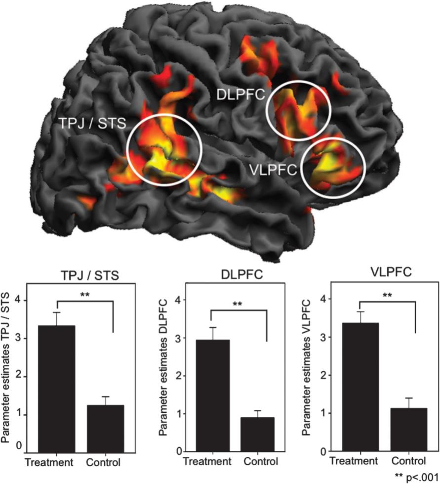 Sharing pain and relief: neural correlates of physicians during treatment of patients KB Jensen et all.