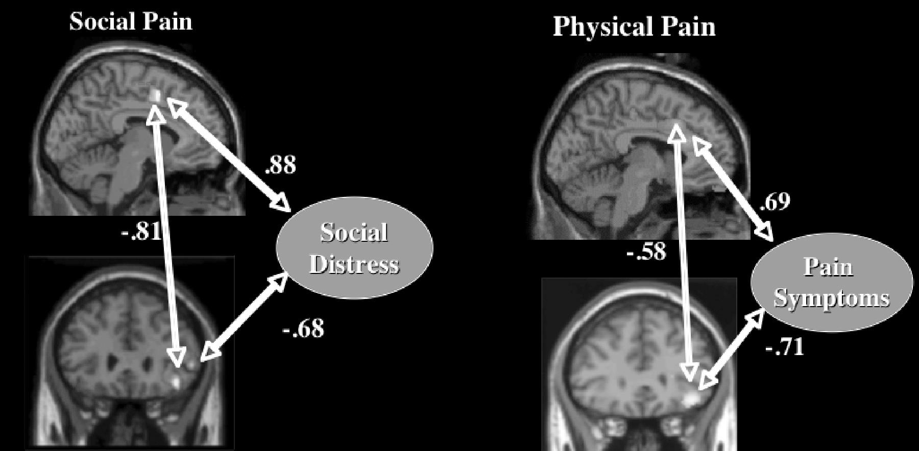 Sociale en fysieke pijn The pains and pleasures of social life: a social cognitive neuroscience approach Lieberman &