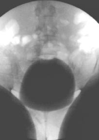 Cystometrisch onderzoek van de