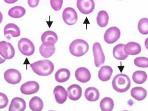 Morfologie Target cells