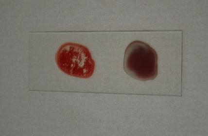 3. Bloedgroepbepaling Tijdens de uitleg over het bloed, zagen we onder andere bloedgroepbepaling.