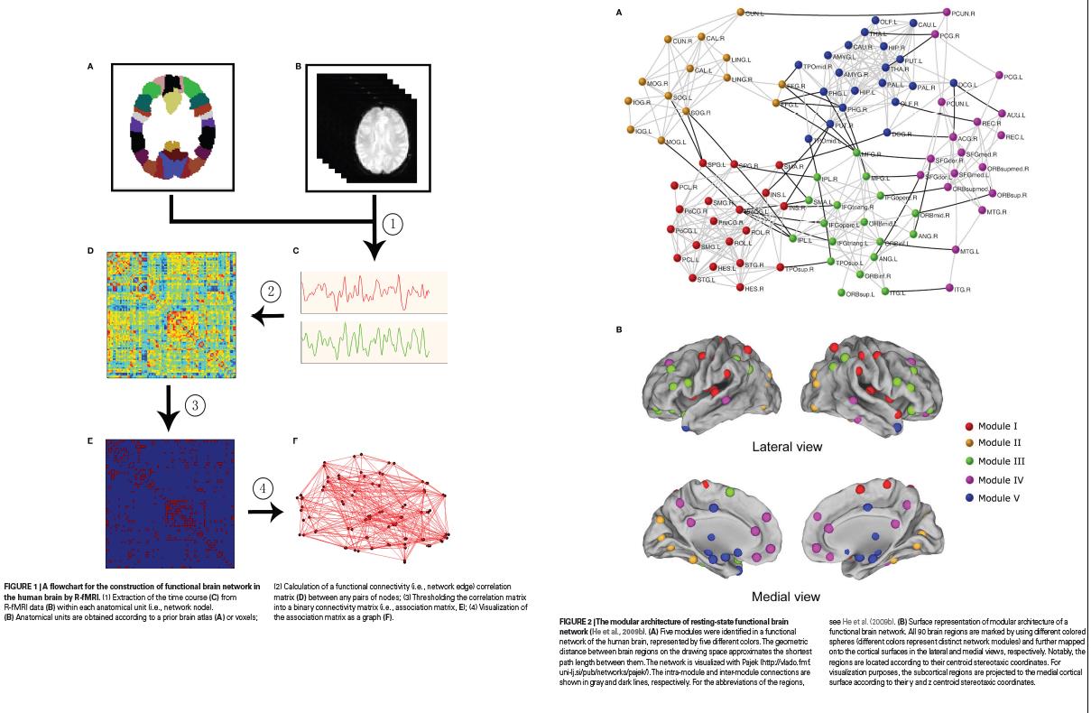 Resting state fmri subnetwerken in kaart brengen Verschillende kleuren = verschillende connecties Binnen dezelfde kleur = sterke correlaties tov andere kleure Patroon classificatie Multivariate