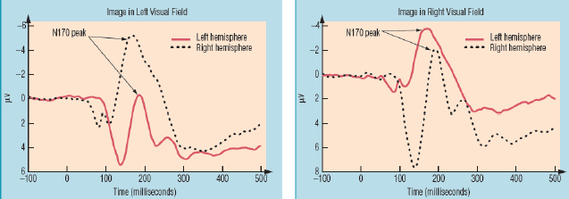 Functies van hemisferische interacties Transfer van informatie Informatieoverdracht is heel snel (5 tot 20 ms) Transfer zorgt voor (beperkte) degradatie van signaal Als aangeboden in rechter visueel