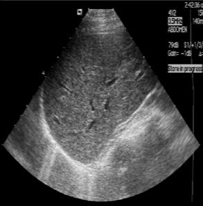 Wat is het verschil met radiologie? Met de scanners op nucleaire geneeskunde wordt voornamelijk de fysiologie van een orgaan of weefsel onderzocht.