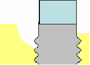 Fig. 5.4. Schematische weergave van Platform Switchting. Bij een relatief smal abutment (A) is de afstand tussen randspleet (pijl) en bot relatief groot.