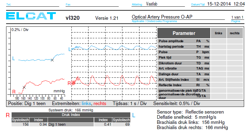 Systolische bloeddrukmeting Dig I : 1) Bloeddrukbandje opblazen 200 mmhg Registratie arteriele pulsatie (PPG