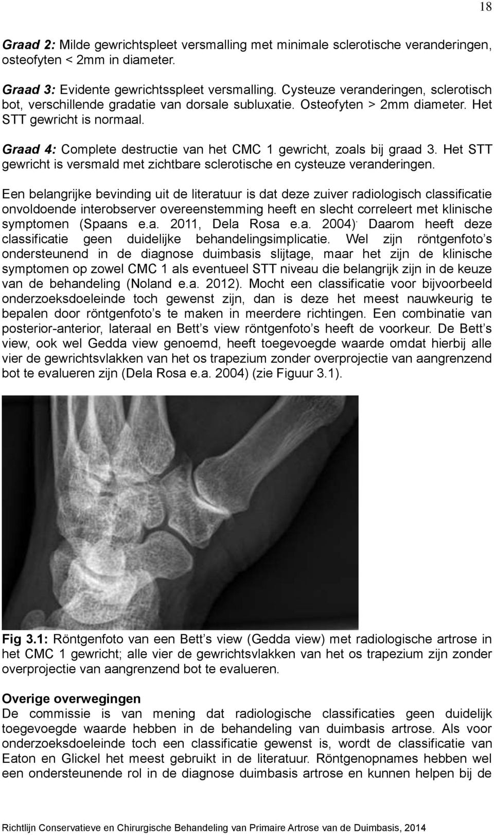 Graad 4: Complete destructie van het CMC 1 gewricht, zoals bij graad 3. Het STT gewricht is versmald met zichtbare sclerotische en cysteuze veranderingen.