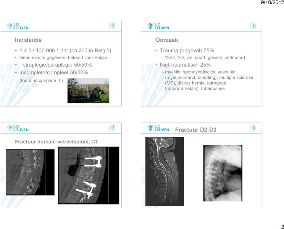 AO, val, sport, geweld, zelfmoord Niet-traumatisch 25% myelitis, spondylodiscitis, vasculair (myeluminfarct,