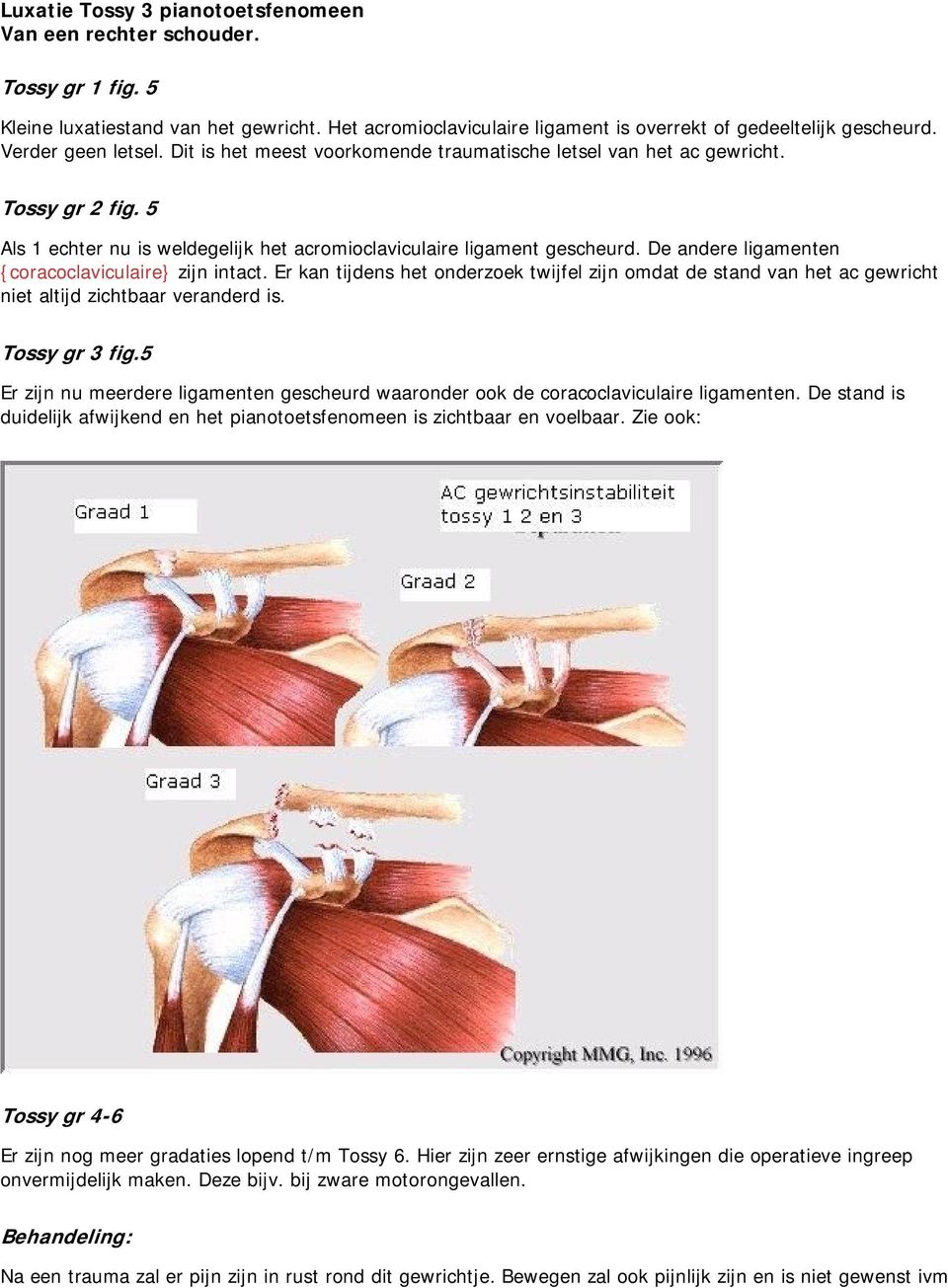 De andere ligamenten {coracoclaviculaire} zijn intact. Er kan tijdens het onderzoek twijfel zijn omdat de stand van het ac gewricht niet altijd zichtbaar veranderd is. Tossy gr 3 fig.