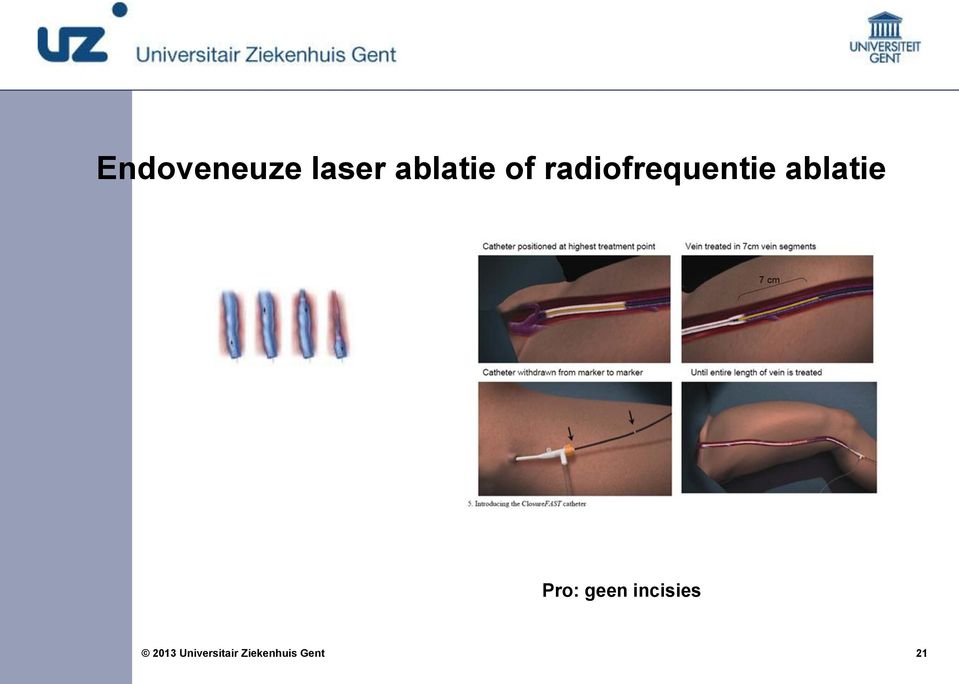 radiofrequentie