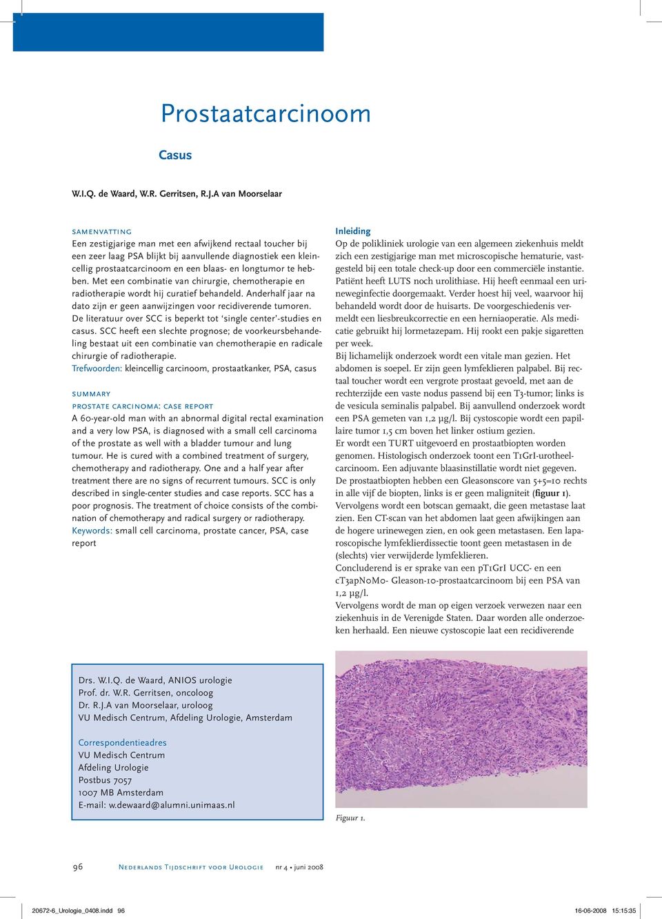 longtumor te hebben. Met een combinatie van chirurgie, chemotherapie en radiotherapie wordt hij curatief behandeld. Anderhalf jaar na dato zijn er geen aanwijzingen voor recidiverende tumoren.