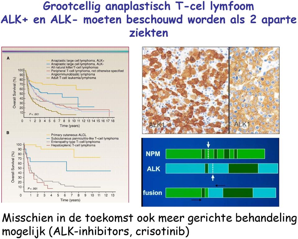 ziekten Misschien in de toekomst ook meer