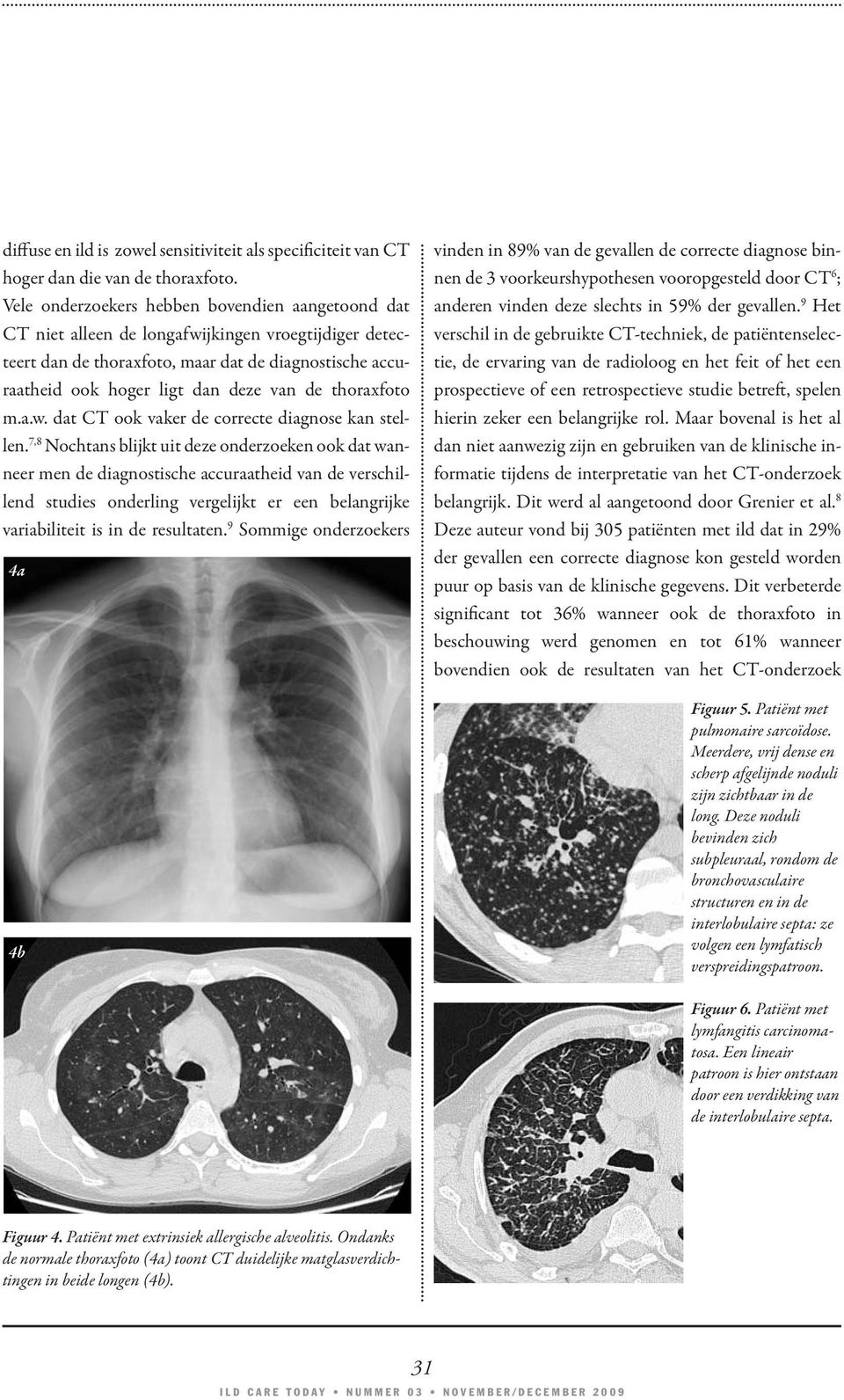 thoraxfoto m.a.w. dat CT ook vaker de correcte diagnose kan stellen.