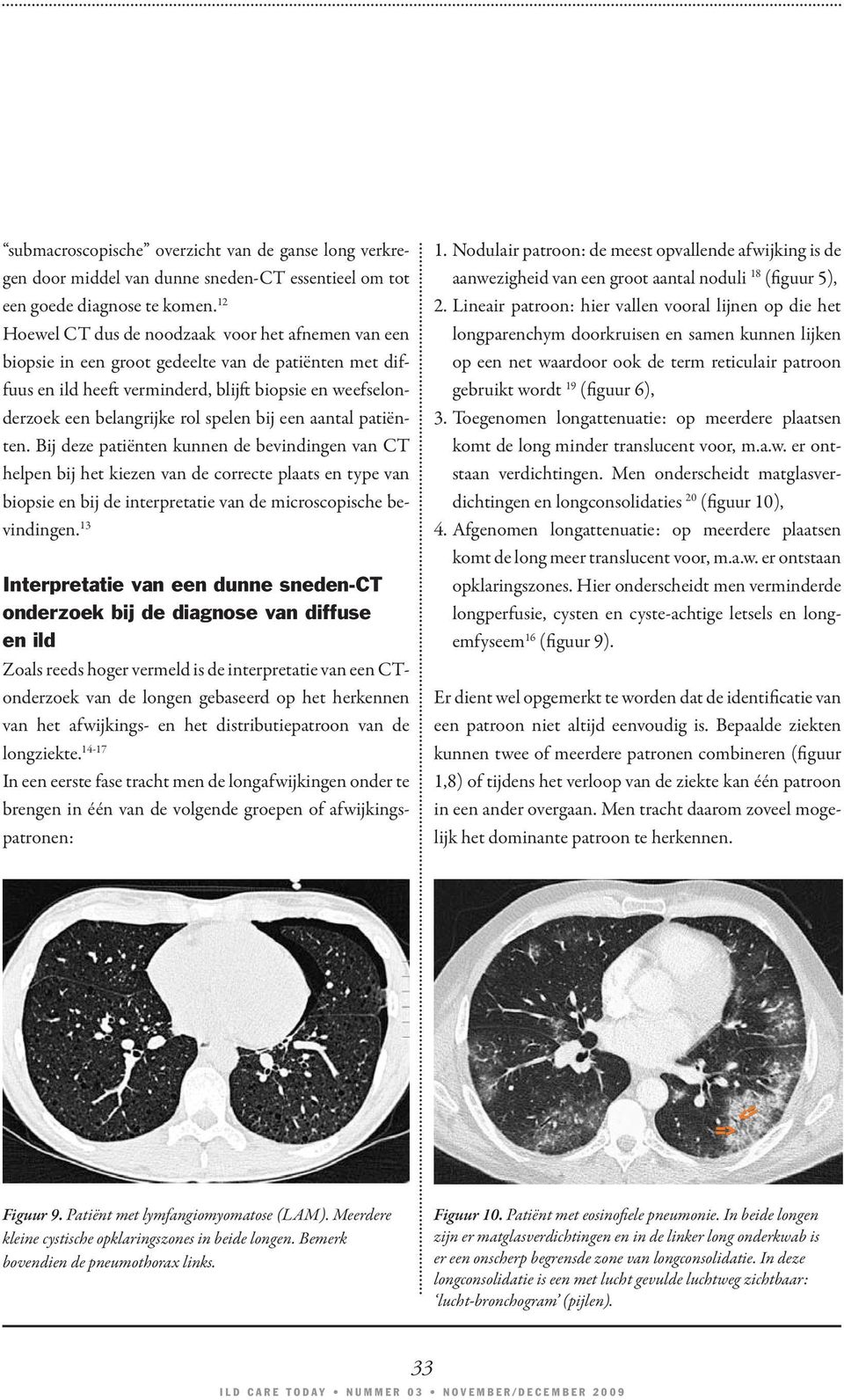 bij een aantal patiënten. Bij deze patiënten kunnen de bevindingen van CT helpen bij het kiezen van de correcte plaats en type van biopsie en bij de interpretatie van de microscopische bevindingen.