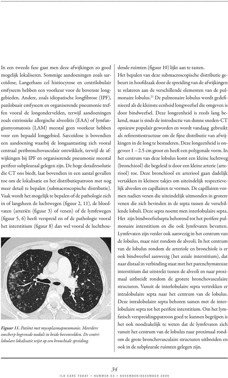 Sommige aandoeningen zoals sarcoïdose, Langerhans cel histiocytose en centrilobulair emfyseem hebben een voorkeur voor de bovenste longgebieden.