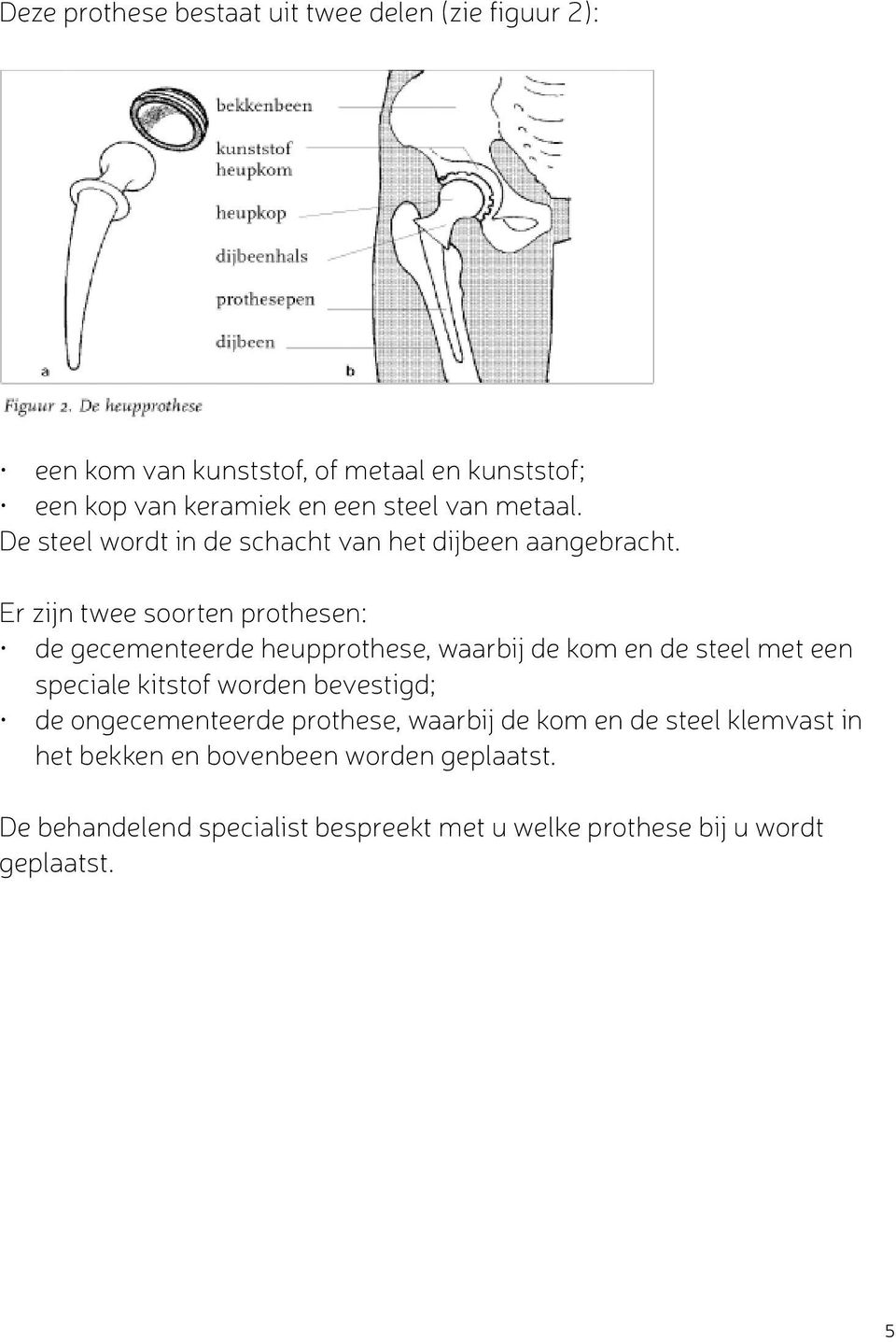 Er zijn twee soorten prothesen: de gecementeerde heupprothese, waarbij de kom en de steel met een speciale kitstof worden