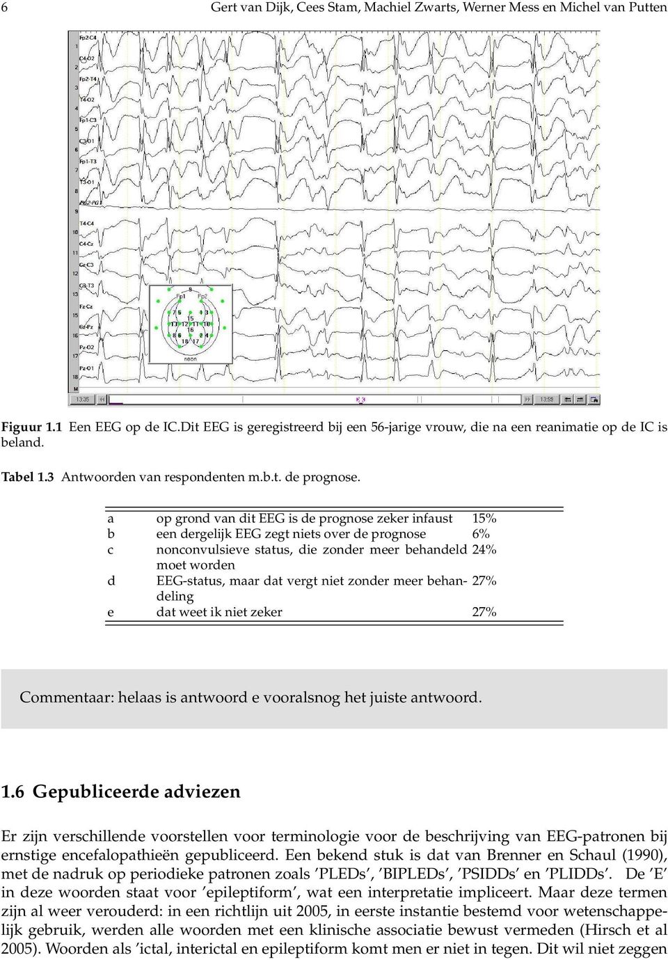 a op grondvan dit EEGisde prognose zekerinfaust 15% b een dergelijk EEG zegt niets over de prognose 6% c nonconvulsieve status, die zonder meer behandeld 24% moet worden d EEG-status, maar dat vergt