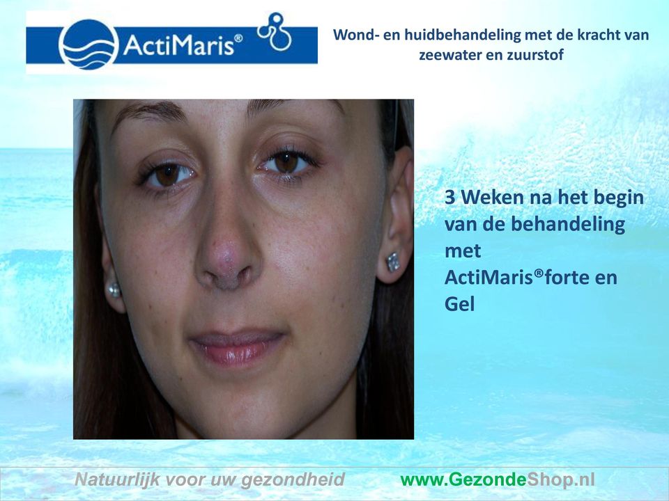 behandeling met