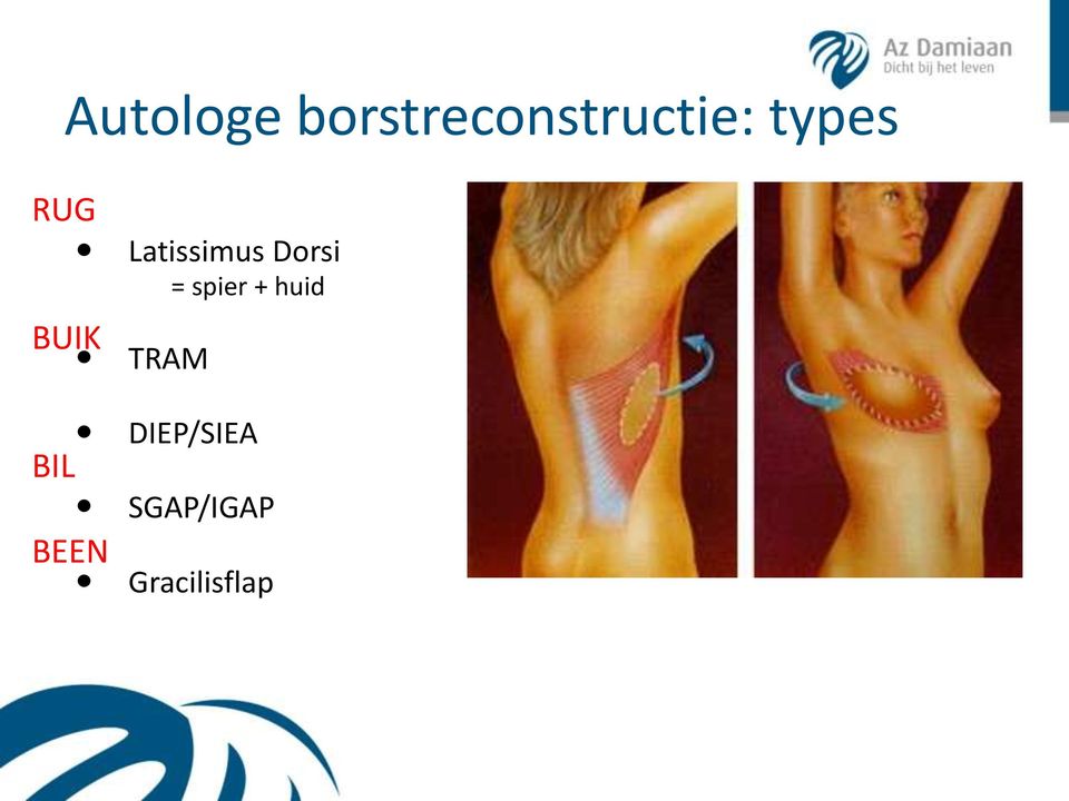 Latissimus Dorsi = spier +