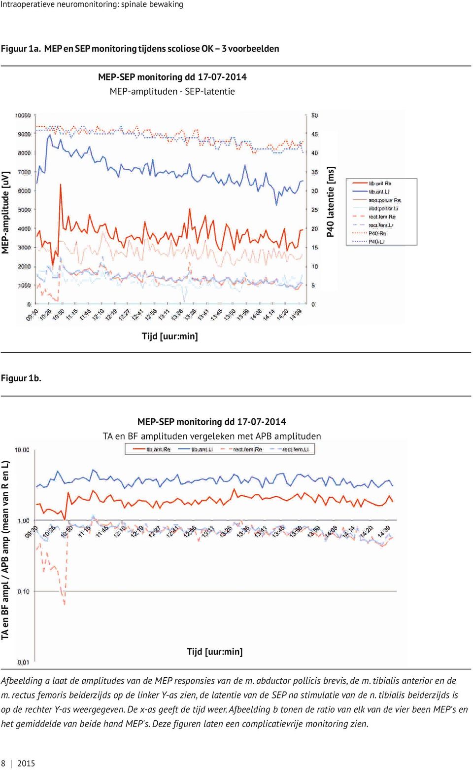 TA en BF ampl / APB amp (mean van R en L) MEP-SEP monitoring dd 17-07-2014 TA en BF amplituden vergeleken met APB amplituden Tijd [uur:min] Afbeelding a laat de amplitudes van de MEP responsies van