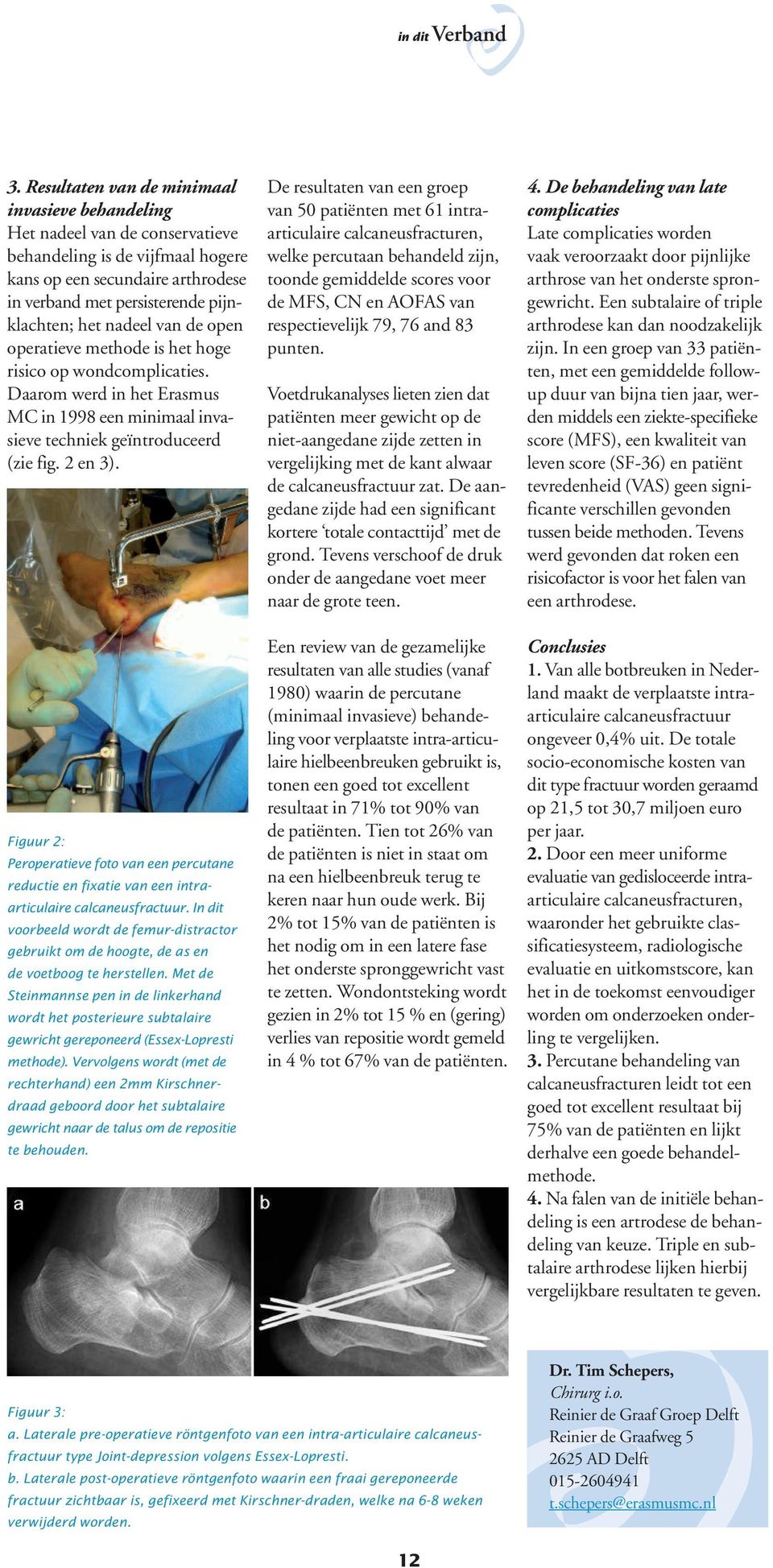 nadeel van de open operatieve methode is het hoge risico op wondcomplicaties. Daarom werd in het Erasmus MC in 1998 een minimaal invasieve techniek geïntroduceerd (zie fig. 2 en 3).