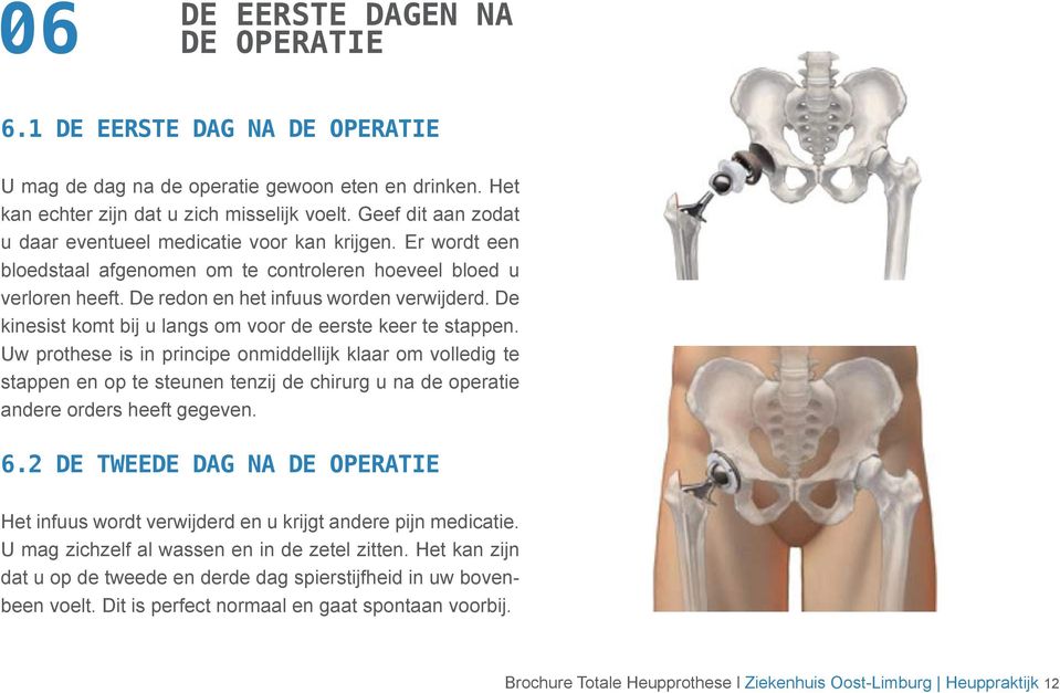 De kinesist komt bij u langs om voor de eerste keer te stappen.