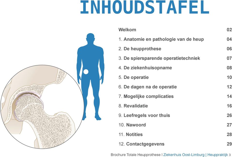 De dagen na de operatie 12 7. Mogelijke complicaties 14 8. Revalidatie 16 9.