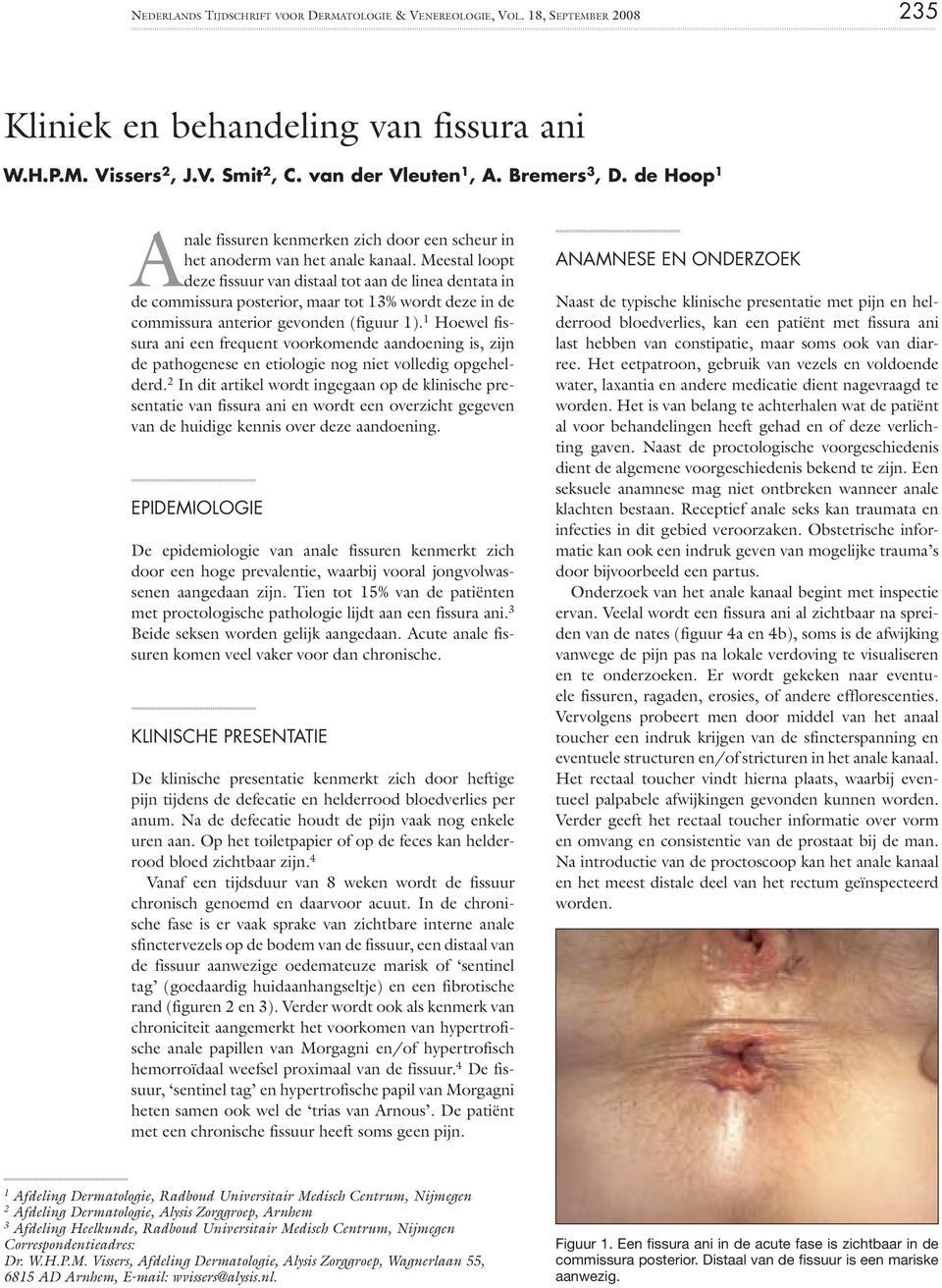 Meestal loopt deze fissuur van distaal tot aan de linea dentata in de commissura posterior, maar tot 13% wordt deze in de commissura anterior gevonden (figuur 1).