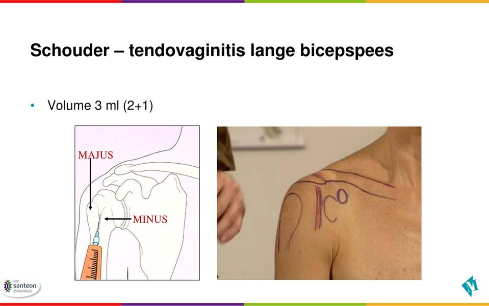 lange bicepspees