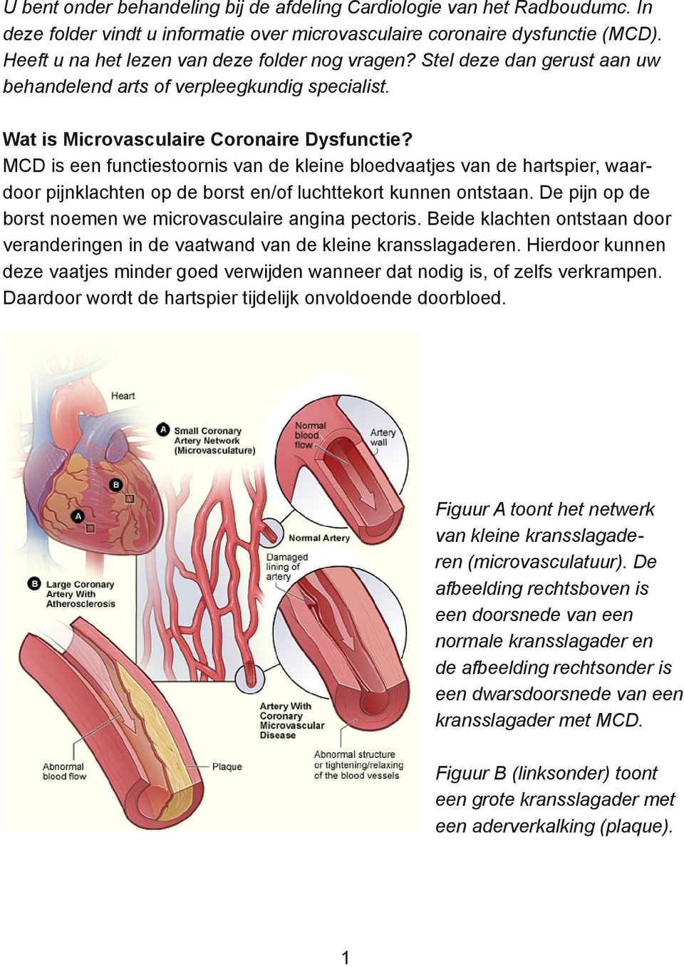 MCD is een functiestoornis van de kleine bloedvaatjes van de hartspier, waardoor pijnklachten op de borst en/of luchttekort kunnen ontstaan.
