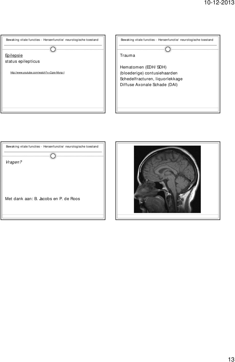 contusiehaarden Schedelfracturen, liquorlekkage Diffuse