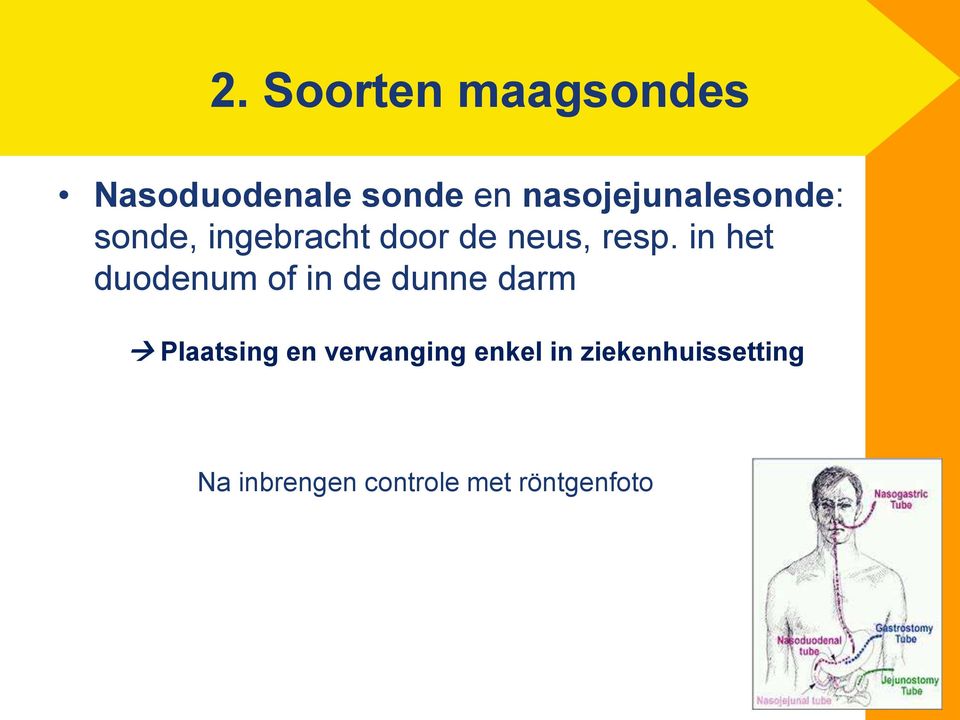 in het duodenum of in de dunne darm Plaatsing en