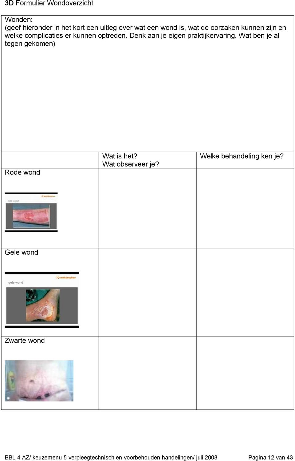 Wat ben je al tegen gekomen) Rode wond Wat is het? Wat observeer je? Welke behandeling ken je?