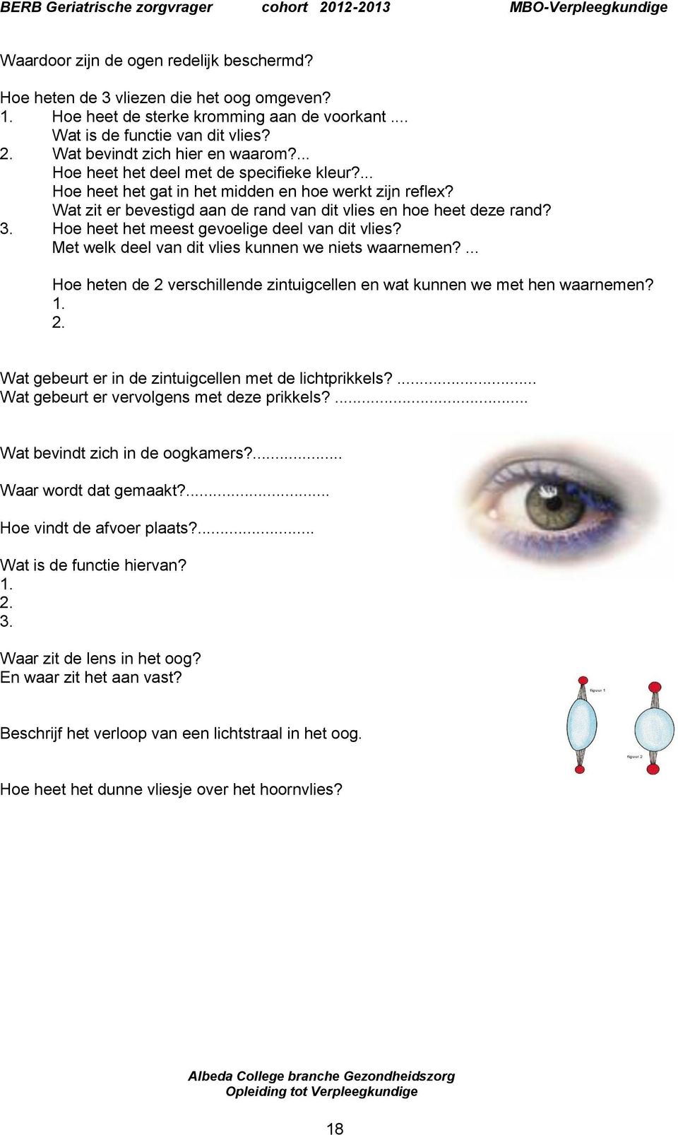 Wat zit er bevestigd aan de rand van dit vlies en hoe heet deze rand? 3. Hoe heet het meest gevoelige deel van dit vlies? Met welk deel van dit vlies kunnen we niets waarnemen?