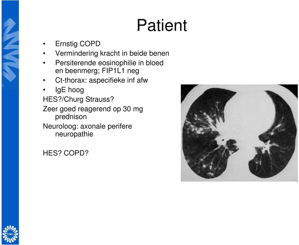 Ct-thorax: aspecifieke inf afw IgE hoog HES?/Churg Strauss?