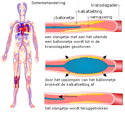 De boezems en kamers worden gescheiden door een hartklep. Deze hartkleppen zorgen ervoor dat het bloed niet tegen de stroomrichting in kan stromen. De mens heeft een dubbele bloedsomloop.