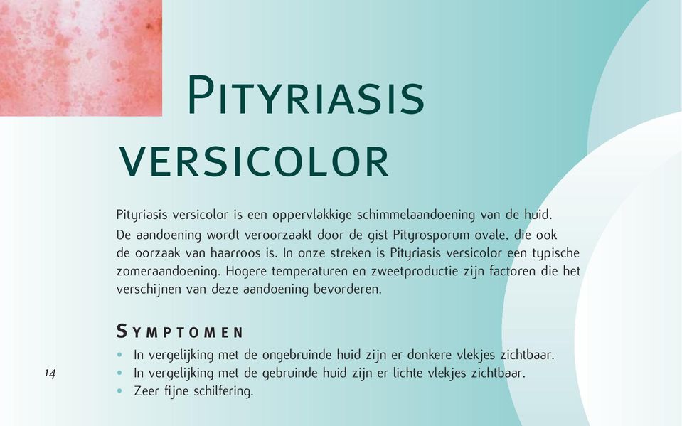 In onze streken is Pityriasis versicolor een typische zomeraandoening.